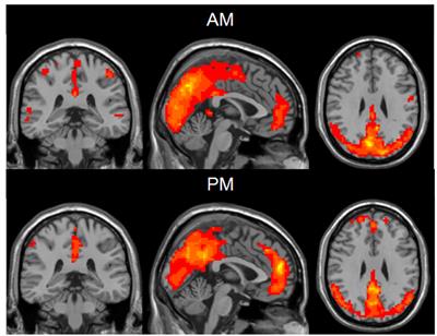 Diurnal Variations in Neural Activity of Healthy Human Brain Decoded with Resting-State Blood Oxygen Level Dependent fMRI